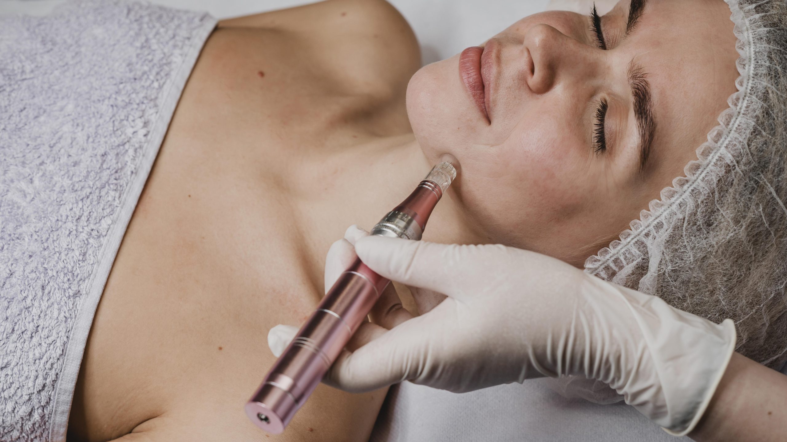 Full Face and Neck Microneedling with Hylarionic Acid and Vitamin-C