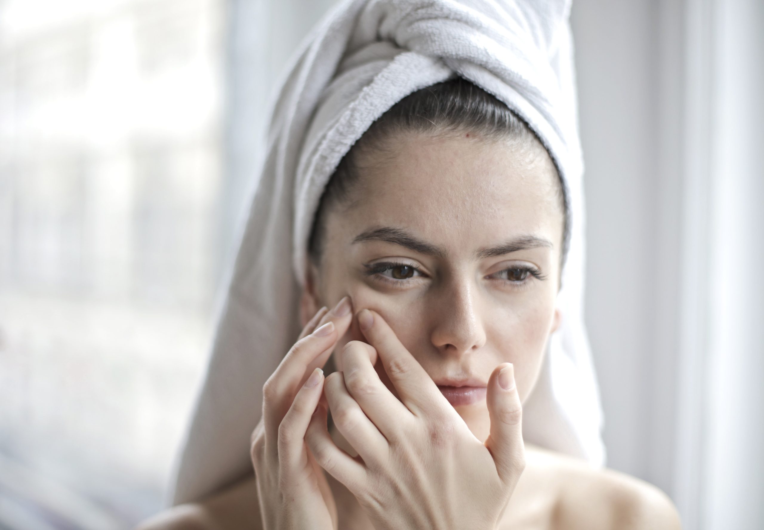 Acne Removal Microneedling with Customised Serum, (3 sessions pack)